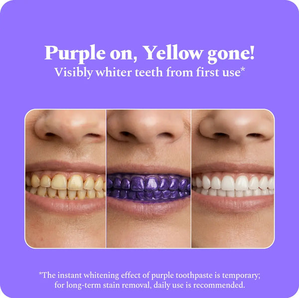Perfora Purple Whitening Toothpaste-75g | Purple Toothpaste For Teeth Whitening | Teeth Stain Remover | Enamel Safe & Effective Teeth Whitener Oral care | Grape Mint