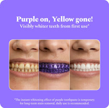 Perfora Purple Whitening Toothpaste-75g | Purple Toothpaste For Teeth Whitening | Teeth Stain Remover | Enamel Safe & Effective Teeth Whitener Oral care | Grape Mint