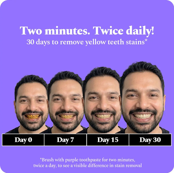 Perfora Purple Whitening Toothpaste-75g | Purple Toothpaste For Teeth Whitening | Teeth Stain Remover | Enamel Safe & Effective Teeth Whitener Oral care | Grape Mint
