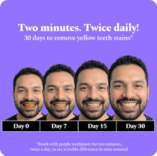 Perfora Purple Whitening Toothpaste-75g | Purple Toothpaste For Teeth Whitening | Teeth Stain Remover | Enamel Safe & Effective Teeth Whitener Oral care | Grape Mint