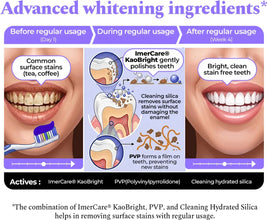 Perfora Purple Whitening Toothpaste-75g | Purple Toothpaste For Teeth Whitening | Teeth Stain Remover | Enamel Safe & Effective Teeth Whitener Oral care | Grape Mint