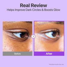 Volumetox Eye Cream 100 gm