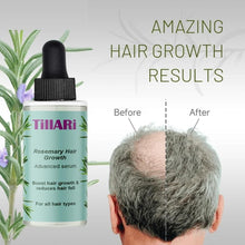 Tillari Rosemary Hair Growth Serum